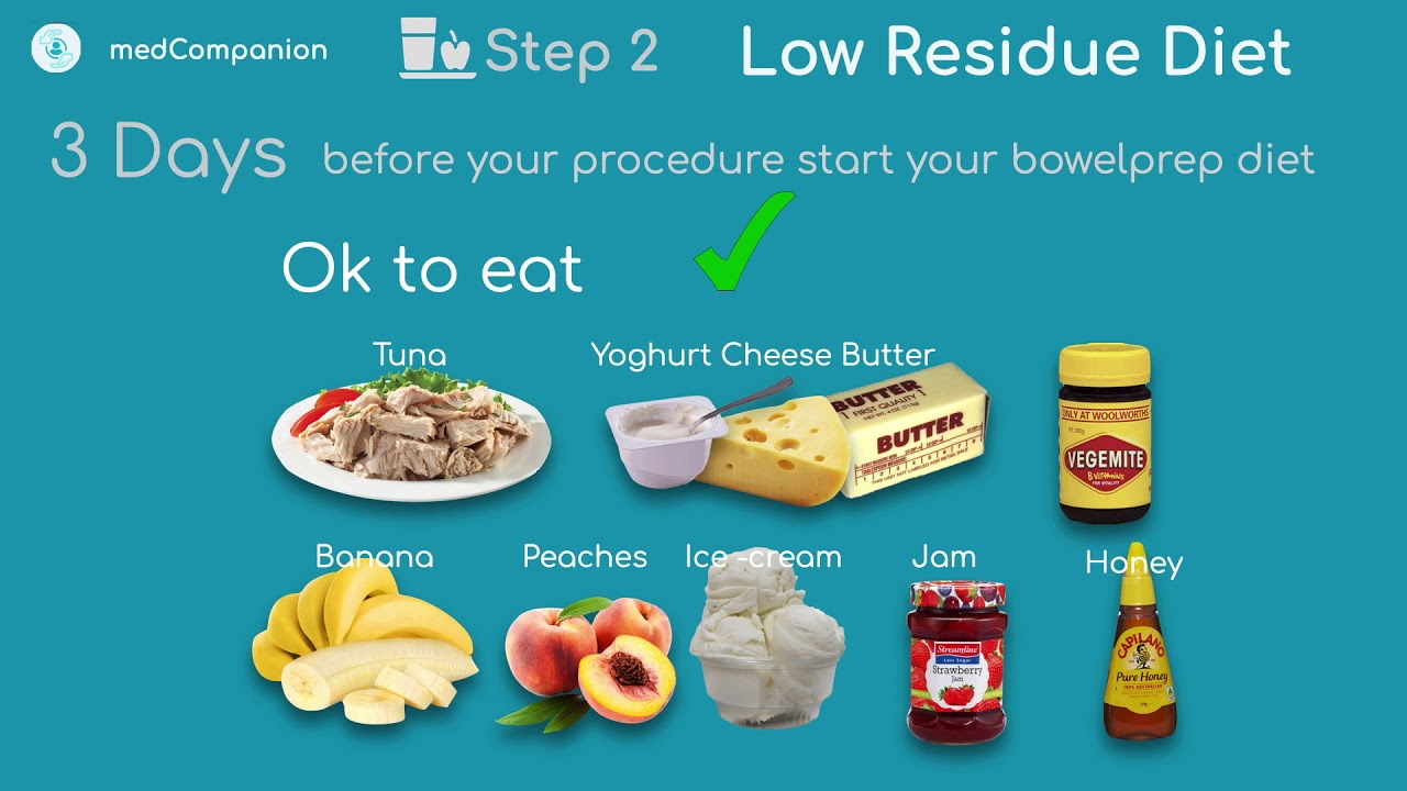 Top 5 Effective Mouse Diet Tips for a Healthier Pet in 2025